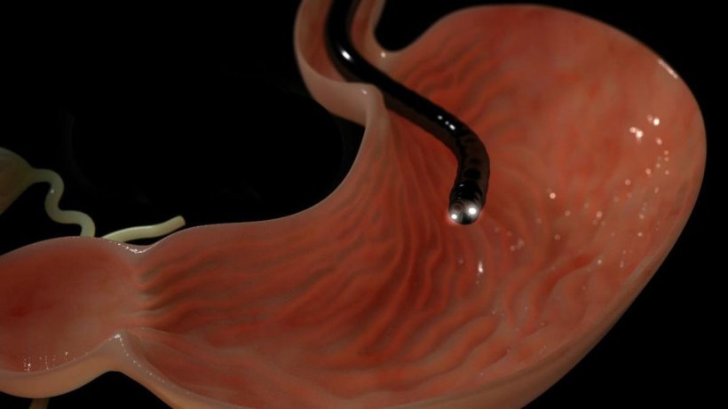 ФГДС